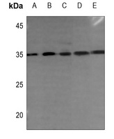 DHRS2 Rabbit Polyclonal Antibody