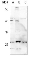 KCNMB2 Rabbit Polyclonal Antibody