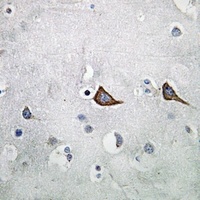 KCNMB2 Rabbit Polyclonal Antibody