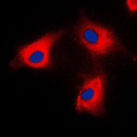 BCKDK Rabbit Polyclonal Antibody