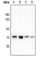 PAK4 (Phospho-S474) Antibody