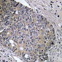 PAK4 (Phospho-S474) Antibody