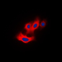 PAK4 (Phospho-S474) Antibody