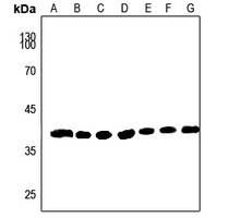 AKR1A1 Rabbit Polyclonal Antibody