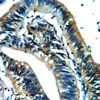 AKR1A1 Rabbit Polyclonal Antibody