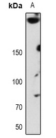 ABCA7 Rabbit Polyclonal Antibody