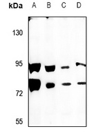 SCML2 Rabbit Polyclonal Antibody