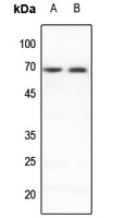 PIAS3 Rabbit Polyclonal Antibody