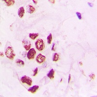 PIAS3 Rabbit Polyclonal Antibody