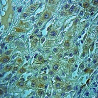 EPAC1 Rabbit Polyclonal Antibody