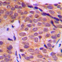 YAP1 Rabbit Polyclonal Antibody