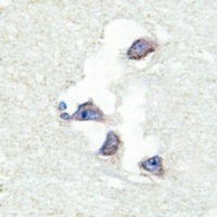 hnRNP Q Rabbit Polyclonal Antibody