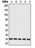 MRPL28 Rabbit Polyclonal Antibody