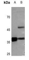 Podoplanin Rabbit Polyclonal Antibody