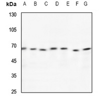 TCP1 theta Rabbit Polyclonal Antibody