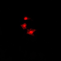 FAST Kinase Rabbit Polyclonal Antibody