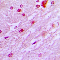 DBF4 Rabbit Polyclonal Antibody