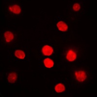 DBF4 Rabbit Polyclonal Antibody