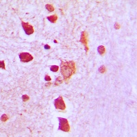 Peroxiredoxin 3 Rabbit Polyclonal Antibody