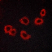 GPR176 Rabbit Polyclonal Antibody