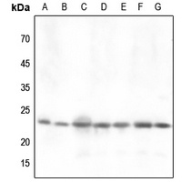 DJ-1 Rabbit Polyclonal Antibody