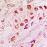 DJ-1 Rabbit Polyclonal Antibody