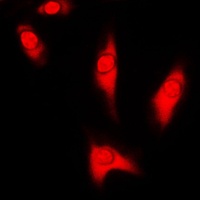 DJ-1 Rabbit Polyclonal Antibody