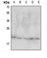 DJ-1 Rabbit Polyclonal Antibody