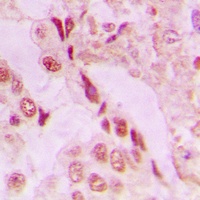 DJ-1 Rabbit Polyclonal Antibody
