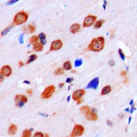 LMTK2 Antibody