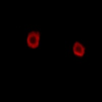 LMTK2 Antibody