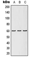 TCP1 epsilon Rabbit Polyclonal Antibody