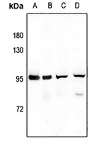 SV2C Rabbit Polyclonal Antibody