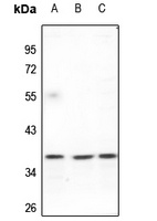 FAIM2 Antibody