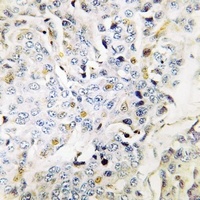 RBM34 Rabbit Polyclonal Antibody