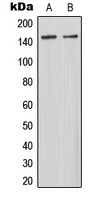 MAST3 Rabbit Polyclonal Antibody
