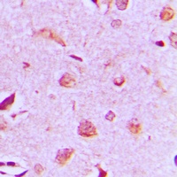 MAST3 Rabbit Polyclonal Antibody