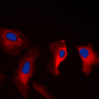 MAST3 Rabbit Polyclonal Antibody