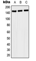 NACAD Rabbit Polyclonal Antibody