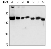 NUP160 Rabbit Polyclonal Antibody