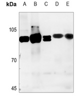 NCAPH Rabbit Polyclonal Antibody