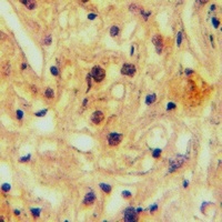 ABCA5 Rabbit Polyclonal Antibody