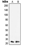 SCC-S2 Antibody