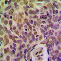 BRMS1 Antibody