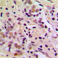 AATF Antibody