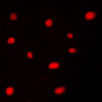 AATF Antibody