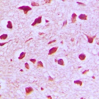 RANBP6 Rabbit Polyclonal Antibody