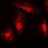 RANBP6 Rabbit Polyclonal Antibody