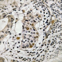 HBP1 (Phospho-S402) Antibody