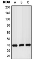GPR160 Rabbit Polyclonal Antibody